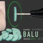 BALU RÄDER 10 Stück medium